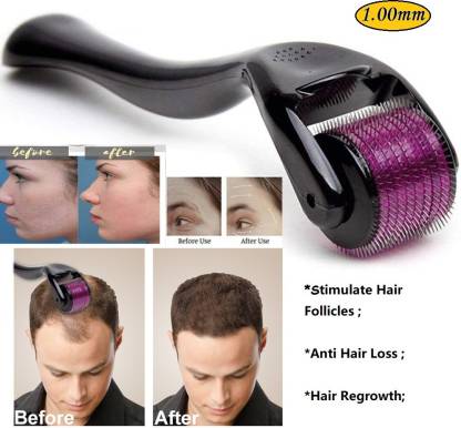Derma Roller Hair Therapy Micro-needle - Image 4